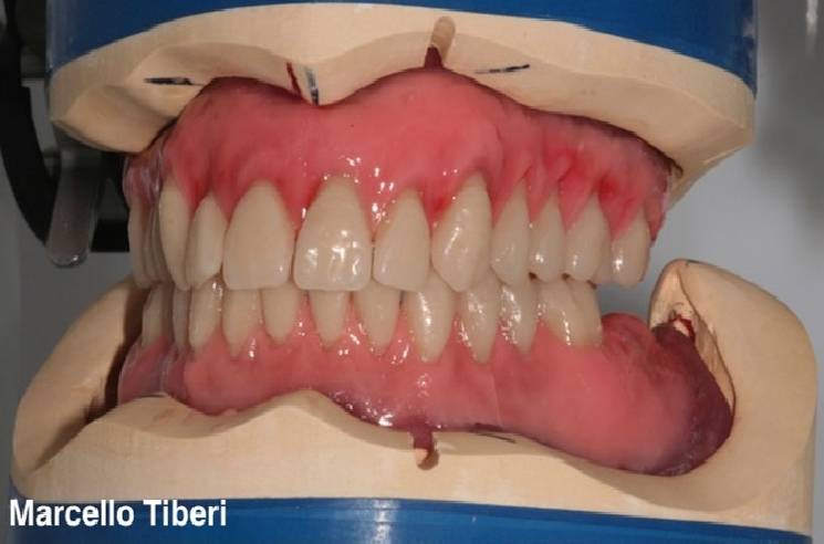 Lab. Tiberi (PE) - Cere Testabili